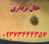 خالبرداری با تخفیف ویژه