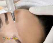 بوتاکس، مزوتراپی و سایر خدمات زیبایی