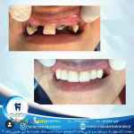 کلینیک دندانپزشکی لبخند،جراحی ایمپلنت پیشرفته،درمان ریشه،ترمیم دندان و ...
