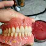 دست دندان کامل آلمانی درجه1
