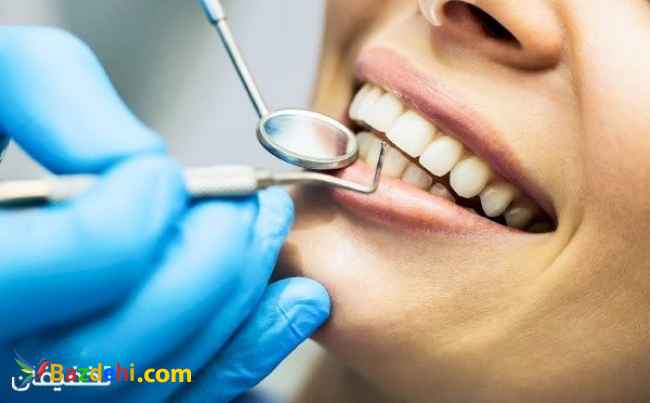 ۲۰ درصد تخفیف دندانپزشکی و آزمایشگاه مراکز معتبر به صورت رایگان